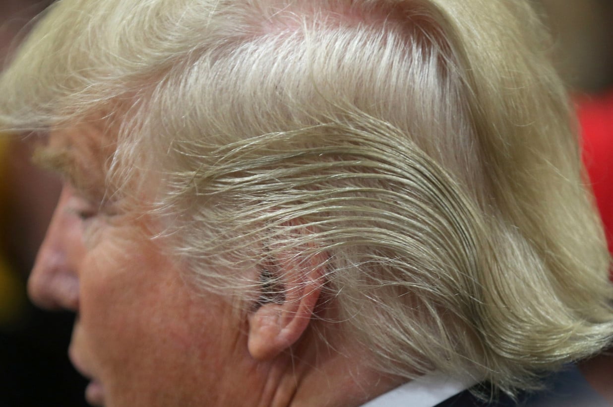 Trump’s Bizarre Hairdo Finally Explained Trump’s Bizarre Hairdo Finally Explained